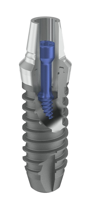 アバットメント